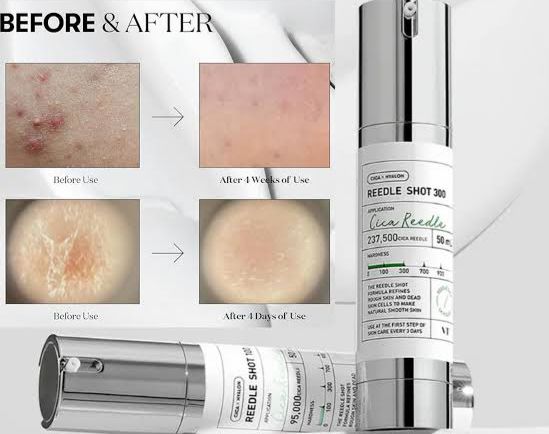 Reedle Shot 100 – Sérum Microneedling