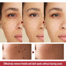 Caneta Laser 2 em 1 para Cuidados com a Pele