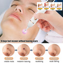 Caneta Laser 2 em 1 para Cuidados com a Pele